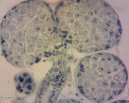 Slide Set, Mitosis & Meiosis