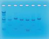 DNA Fingerprinting Using Restriction Enzymes