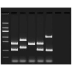 Edvotek® VNTR Human DNA Typing Using PCR Kit