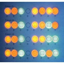 DNA/RNA Microarrays