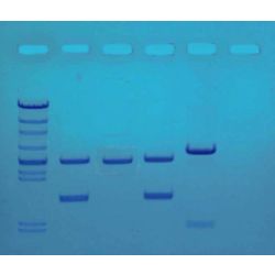 Edvotek® DNA Fingerprinting by PCR Amplification Kit