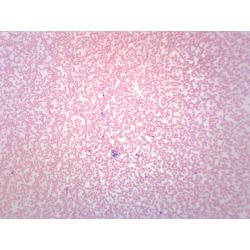 Prepared Slide,Human Blood Smear, Stained