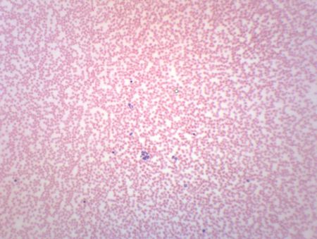 Prepared Slide,Human Blood Smear, Stained