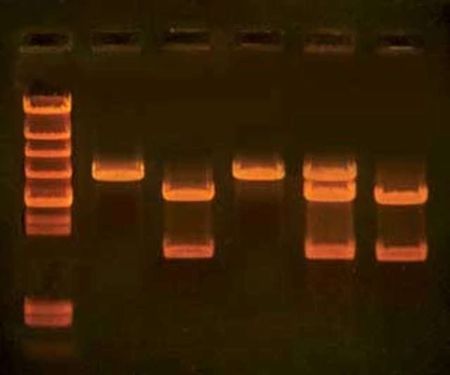 In Search of the Cholesterol Gene Kit