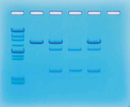 Cancer Gene Detection