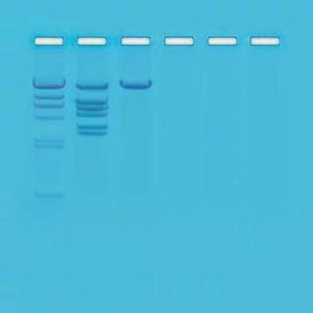 Restriction Enzyme Analysis Of DNA