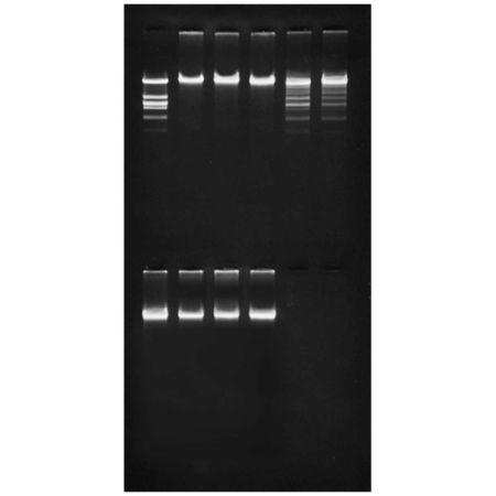 Edvotek� Purification of the Restriction Enzyme Eco RI Kit