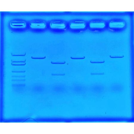 Using CRISPR To Treat Cystic Fibrosis