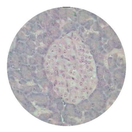 Prepared Slide, Islets of Langerhans and Exocrine Acini