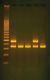 Blue/White Cloning DNA Fragment & Assay Of SS-Galactosidase