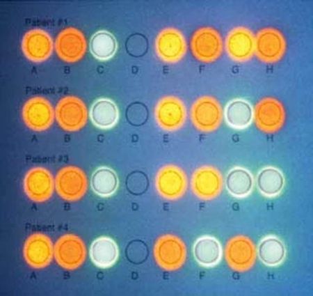 DNA/RNA Microarrays