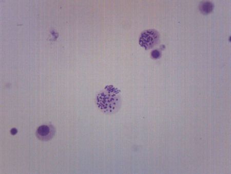 Prepared Slide, Human Chromosomes Male