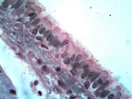 Prepared Slide, Epithelium Human Mouth Scrapings