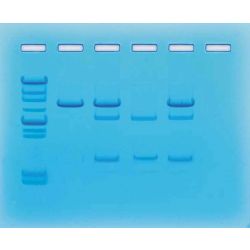 Edvotek® Cancer Gene Detection Kit