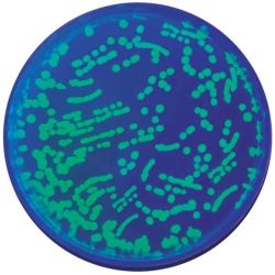 Transformation of E. Coli with Green Fluorescent Protein (GFP)