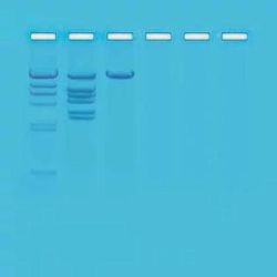 Edvotek® Restriction Enzyme Analysis Of DNA Kit