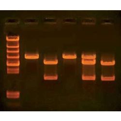 In Search of the Cholesterol Gene Kit