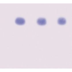 Aids Kit II: Simulation Of HIV Detection By Western Blot