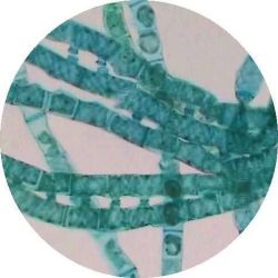 Prepared Slide, Spirogyra Vegetative Filaments