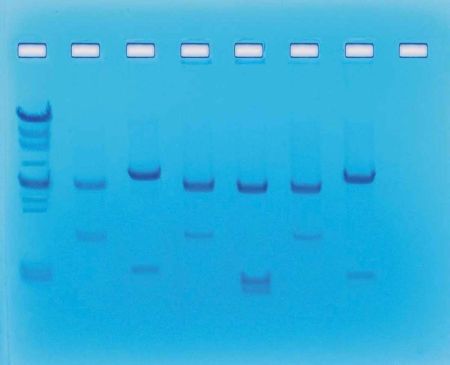 DNA Fingerprinting Using Restriction Enzymes