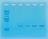 Amplification of DNA By PCR Kit