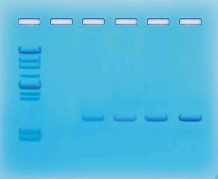 Amplification of DNA By PCR Kit