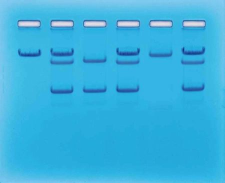 Genetic Disease Screening Kit