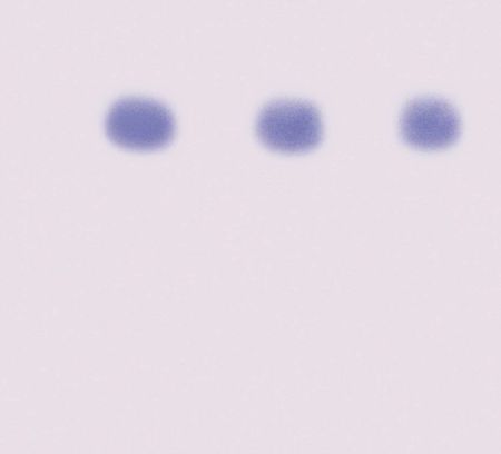 Aids Kit II: Simulation Of HIV Detection By Western Blot